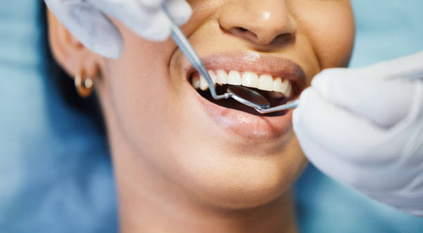 Best Emergency Tooth Extraction in Morrow, OH